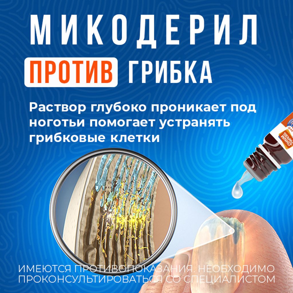 Микодерил, 1%, раствор для наружного применения, от грибка ногтей, 20 мл, 1 шт.